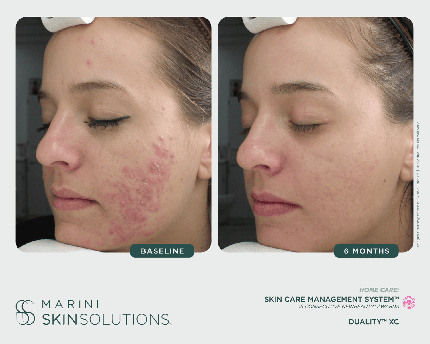 Duality XC — Faccia Duality XC — Faccia
